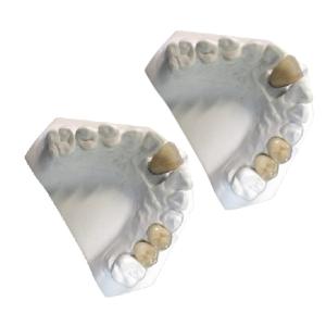Wholesale Lab Yellow Gold Porcelain Dental Crown Co-Cr PFM Porcelain Crown from china suppliers