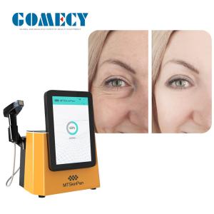Wholesale 2 PCS Nano-L RF Heads Microneedle RF Device for Effective Face Lifting and Wrinkle Reduction Beauty Treatment from china suppliers