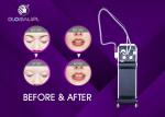 1500W Q Switch Laser Tattoo Removal Machine 1 - 15 HZ Frequency CE Approved