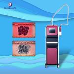 Skin Rejuvenation Tattoo Removal ND YAG Laser Machine 1500W High Power