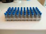 High Strength Dental Amalgam Capsule Spills 2 600mg Blue Color For Dentistry