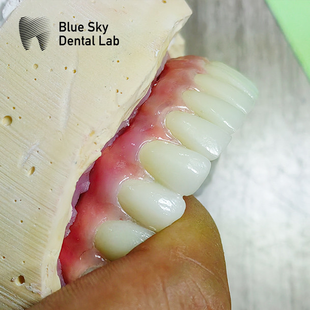 Implant Cases with Sleek Surface for Optimal Surgical Outcomes