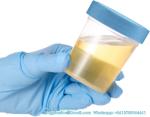 Specimen Cups With Leak Proof Screw On Lids - 4oz Clear Non-Sterile Urine Sample