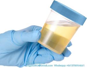 Wholesale Specimen Cups With Leak Proof Screw On Lids - 4oz Clear Non-Sterile Urine Sample Jars - Containers from china suppliers