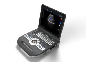 China Portable Ultrasound Device Portable Ultrasound Scanner Color Doppler with 2 USB Ports on sale