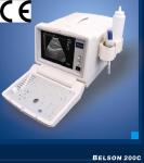 Portable Ultrasound Machine for Pregnancy Portable Ultrasound Scanner Only 2