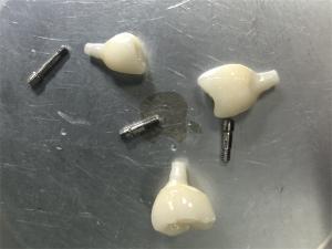 Wholesale Zirconia implant restoration No color problem from china suppliers
