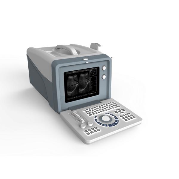 Digital Portable Ultrasound Scanner Medical Equipment 128 Images