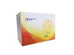 High Precision Human Deoxypyridinoline Crosslinks DPD ELISA Kit 96 Wells