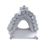 Strong Adhesion Permanent Crown Resin High Strength Long-Lasting Restorations