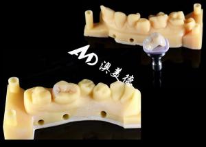 Wholesale Smooth Hypoallergenic Ceramic Inlays Onlays Custom Fit Stain Resistance High Durability from china suppliers
