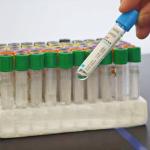 SODIUM CITRCTE MIXTURE (1:9 RATIO) BLUE CAP BLOOD TUBE