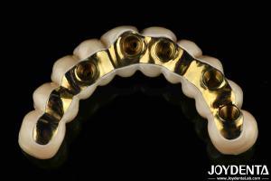 Wholesale Custom Made Ti-Bar Zirconia Hybrid Bridge Precision Fit Dental Prosthesis from china suppliers