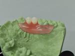 Invisible Denture Base Resin Flexible Denture for Partial and Temporary Dentures
