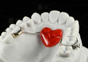 Wholesale Stainless Steel Orthodontic Nance Appliance Horseshoe Design Orthodontic Appliances from china suppliers