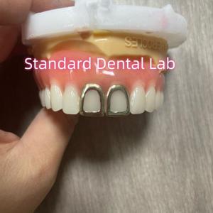 Wholesale ISO Full Acrylic Dentures With Yellow Gold Teeth Open Face from china suppliers