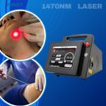 1470nm Face Lifting Lipolysis Laser Liposuction Machine Laser Fat Removal Endo