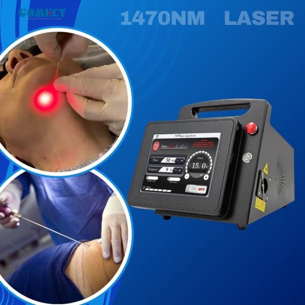 1470nm Face Lifting Lipolysis Laser Liposuction Machine Laser Fat Removal Endo