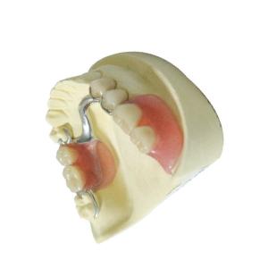 Wholesale Custom Made Dental Lab Products Polymer Removable Partial Dentures from china suppliers