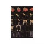 Medical X-ray Dry Film Medical X-ray Inkjet Film With Clear Image Quality