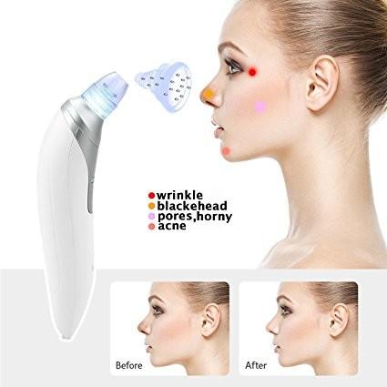 Microcrystalline head Blackhead Remover Pore Vacuum Cleaner Black Head Whitehead