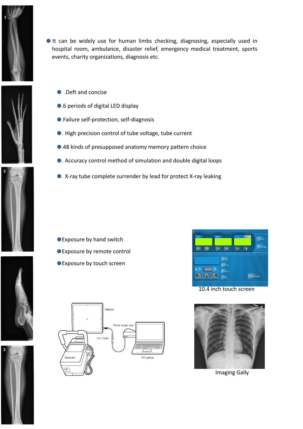 STXR-Y100 Digital Portable X Ray Machine High Frequency For Clear And Detailed Imaging