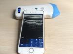 New products Phone / Android wireless USB probe mobile phone ultrasound for