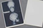 White Medical Paper Chest X Ray Film Waterproof High Sharpness