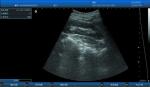 Popular 3D Digital Laptop Veterinary Ultrasound Scanner Lightweight Easy To