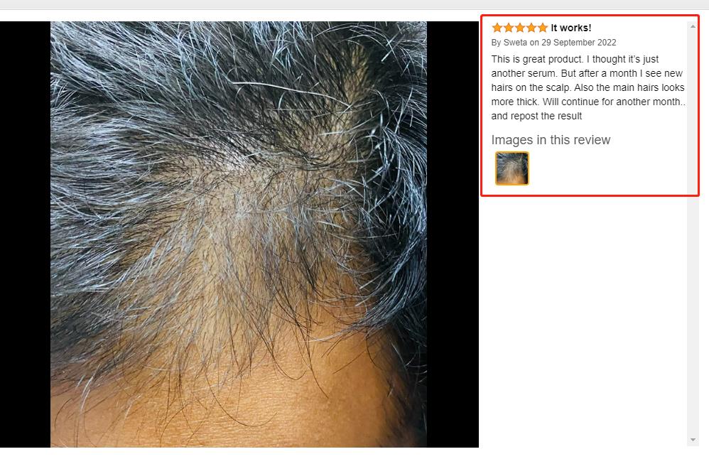 Customization Hair Growth Treatment Serum for Black Women Private Label