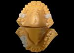 Customized Aesthetic Zirconia Dental Crown Perfectly Fitted for Anterior and