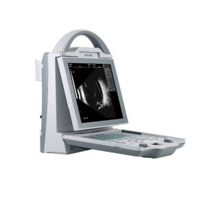 Wholesale Ultrasound Scanning LCD Ophthalmological Instruments With 10MHz A Probe from china suppliers