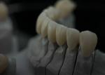 Dental Solid Zirconia Crown Ombining Outstanding Strength And Natural Aesthetics