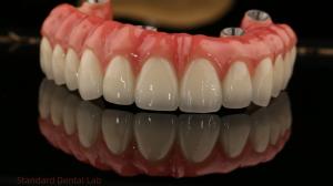 Wholesale Full Arch Zirconia Implants Bridge Zirconia Crown Vita Shade Customized All On Four / Six Dental Implant from china suppliers