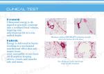 Powerful body shaping professional high intensity focused ultrasound hifu