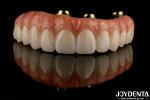 Comfortable Wear Titanium Bar Zirconia Hybrid Bridge High Biocompatibility Long