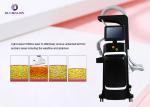 CE Approval 1060nm ND YAG Laser Machine 60W Each Applicator Power US320L