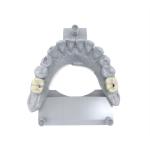 Long-Lasting Low Water Absorption Permanent Crown Resin for Porcelain-Filled