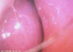 ENT Endoscopy Camera ENT Video Rhinoscope Laryngoscope Examination Unit