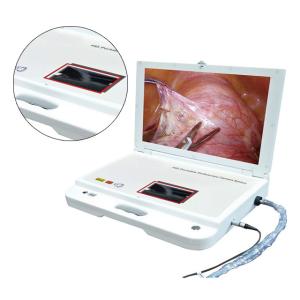 Wholesale Hospital Machine Digital Video Portable Endoscope System from china suppliers