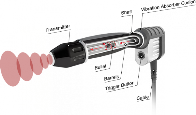 latest company case about Astiland Shockwave Therapy Machine Introduction  6