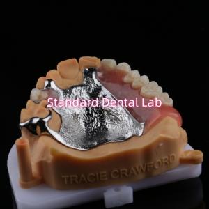 Wholesale Upper Cast Framework Acrylic Metal Partial Dentures Strong Lightweight and Durable from china suppliers