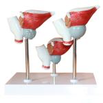 Human Anatomy PVC Simulation Human Pathology Prostate Model For Medical