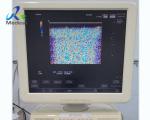 Aloka Image Bright Channel Interference Ultrasound Machine Repair RDBF Board