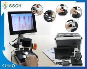 Wholesale Portable Video Microcirculation Microscope Nailfold Capillary with CE from china suppliers