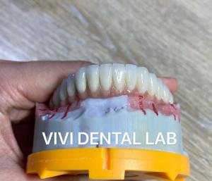Wholesale Digital Cement Dental Bridge Implant Translucency FDA Certified from china suppliers
