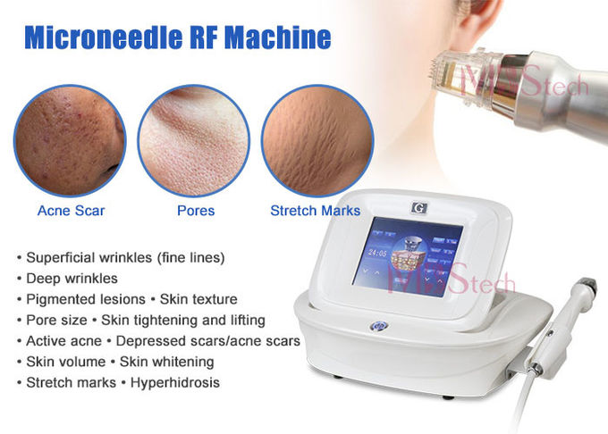 Noninvasive Weight Loss 10 Pins Microneedling Rf Machine