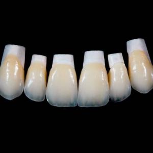 Wholesale High Translucency Emax Porcelain Veneers Crown with Better Materials by Ivoclar Vivadent from china suppliers