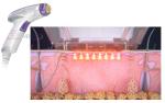 Fractional Rf Microneedle Radio Frequency Skin Tightening Machine