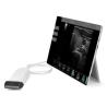 Buy cheap Ultrasound Scan Equipment Portable Ultrasound Scanner Ipad Ultrasound Machine from wholesalers